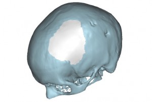 Biomodelação 3D